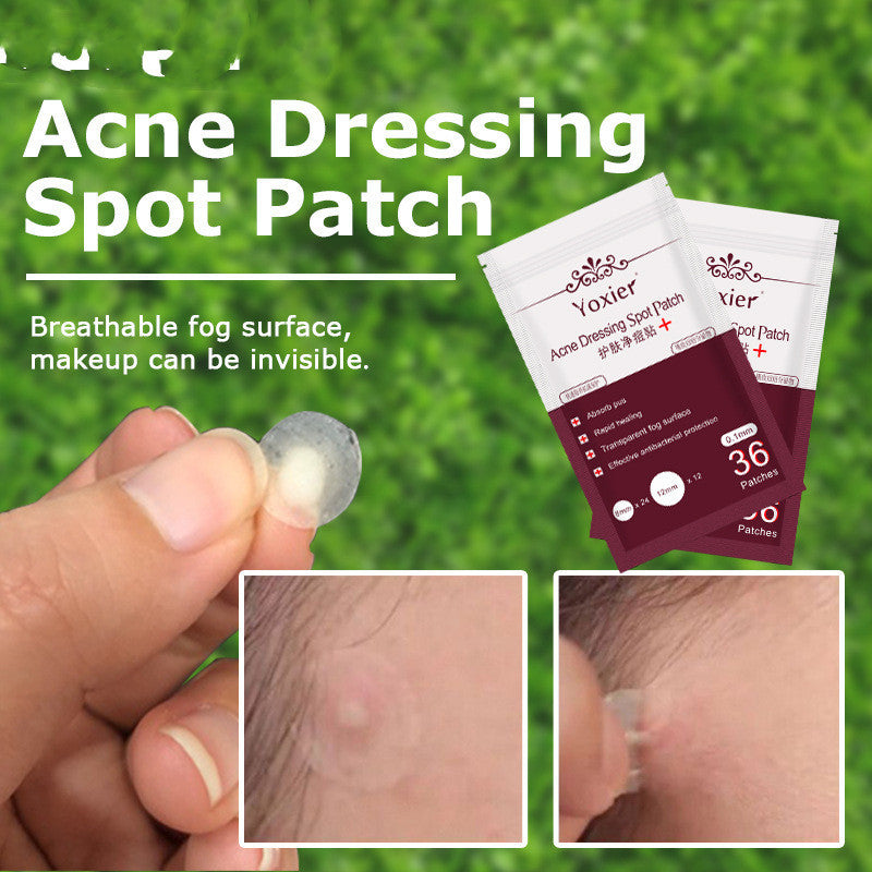Invisible Acne Patch – Heals and protects pimples fast.